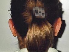 Po operacji Po operacji