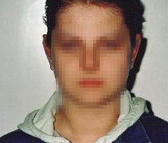 Po operacji Po operacji